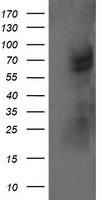 TRMT2A Antibody
