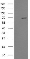 TRMT2A Antibody