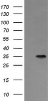 Asialoglycoprotein Receptor 2 Antibody