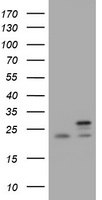 NDUFB10 Antibody
