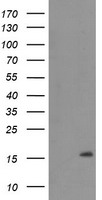 TMEM230 Antibody