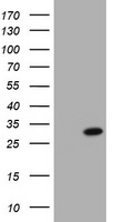 PFDN3 Antibody