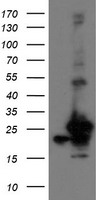 PFDN3 Antibody