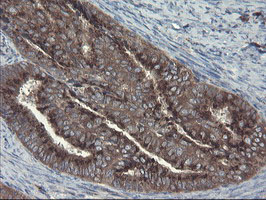 ACBD3 Antibody