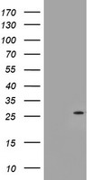 NQO2 Antibody