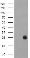 UBE2E3 Antibody