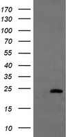 UBE2E3 Antibody