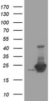 UBE2E3 Antibody
