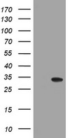 NANP Antibody