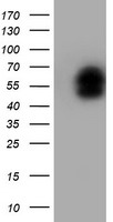 LIM1 Antibody