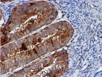 Cystatin C Antibody