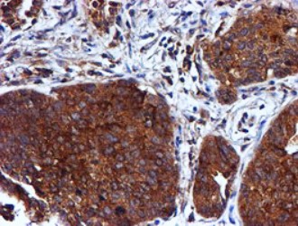 Cystatin C Antibody