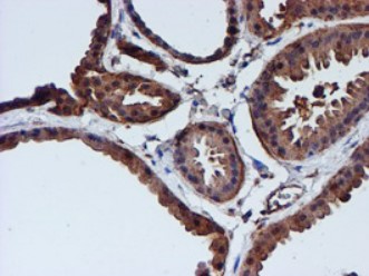 Cystatin C Antibody
