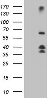 Dystrobrevin beta Antibody
