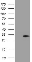 MMACHC Antibody