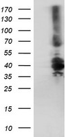 Dystrobrevin beta Antibody