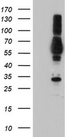 TULP3 Antibody