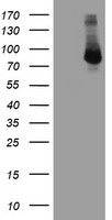 FBXO21 Antibody