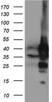 ALS2CR1 Antibody