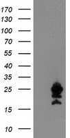 UBE2M Antibody