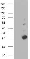 DTYMK Antibody