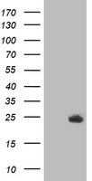 DTYMK Antibody