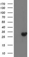 DTYMK Antibody