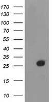 DTYMK Antibody