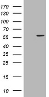 Cytochrome P450 17A1 Antibody