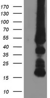 GATM Antibody