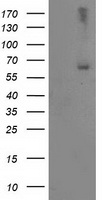 LIM Kinase 1 Antibody