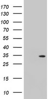 TOMM34 Antibody