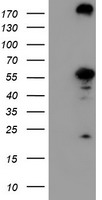 CNDP2 Antibody