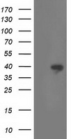 CRALBP Antibody