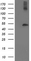 beta IV Tubulin Antibody