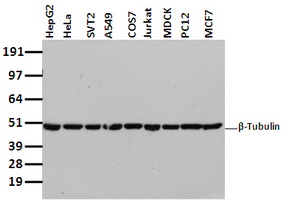 TUBB4A Antibody