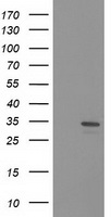 HDHD2 Antibody