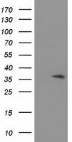 ACY3 Antibody