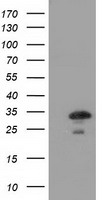 CTDSP1 Antibody