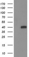 HAO1 Antibody