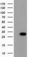 PBLD Antibody