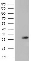 OTUB2 Antibody