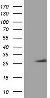 OTUB2 Antibody