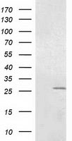 OTUB2 Antibody