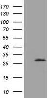 OTUB2 Antibody