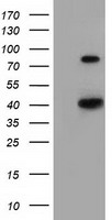 HAO1 Antibody