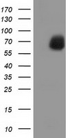 EPM2AIP1 Antibody