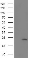 SOD2 Antibody