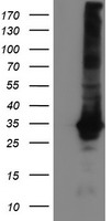 Glutathione S Transferase theta 2 Antibody