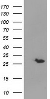 Glutathione S Transferase theta 2 Antibody
